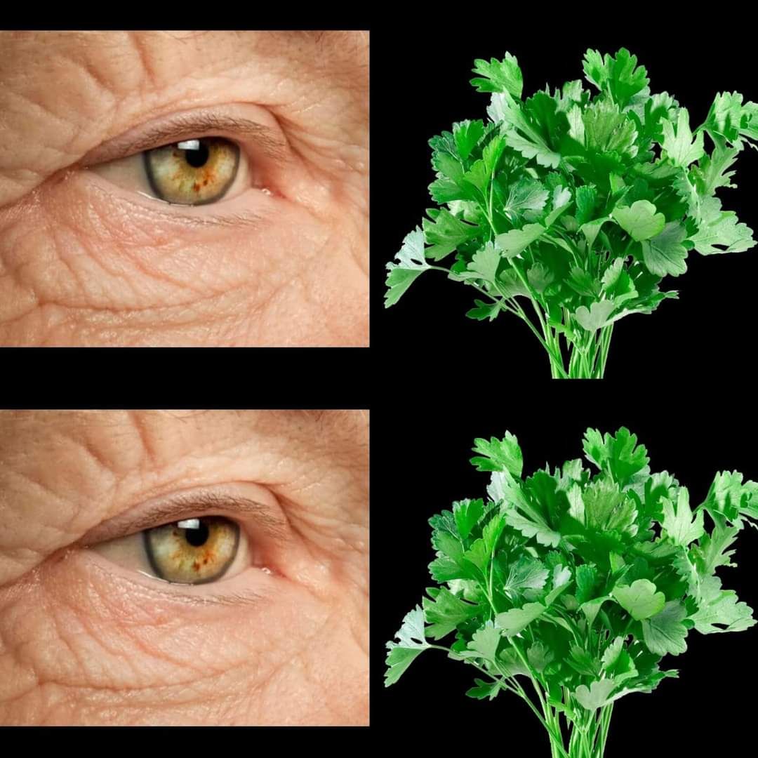 I Have Completely Restored My Vision Again 1