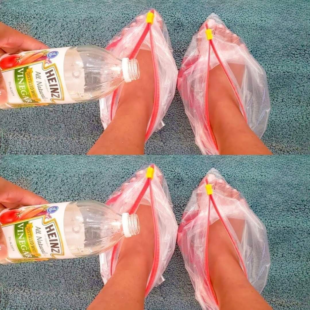 The Wonders of Vinegar for Your Feet 1