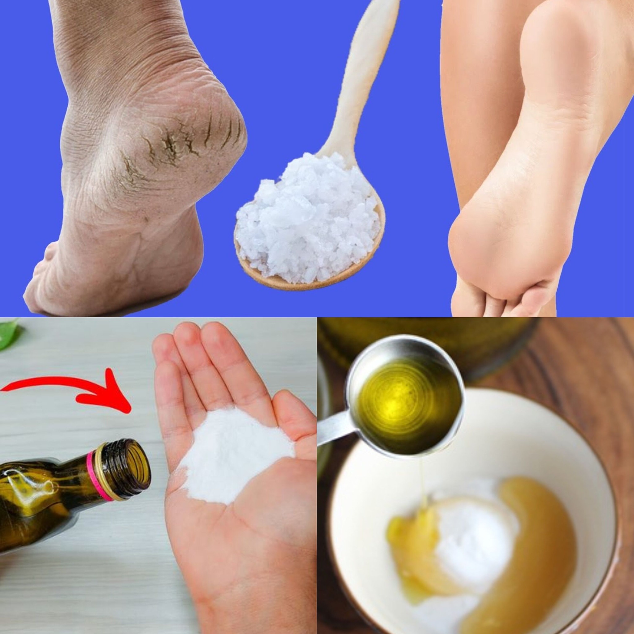 Use Baking soda and olive oil to soften cracked heels 1