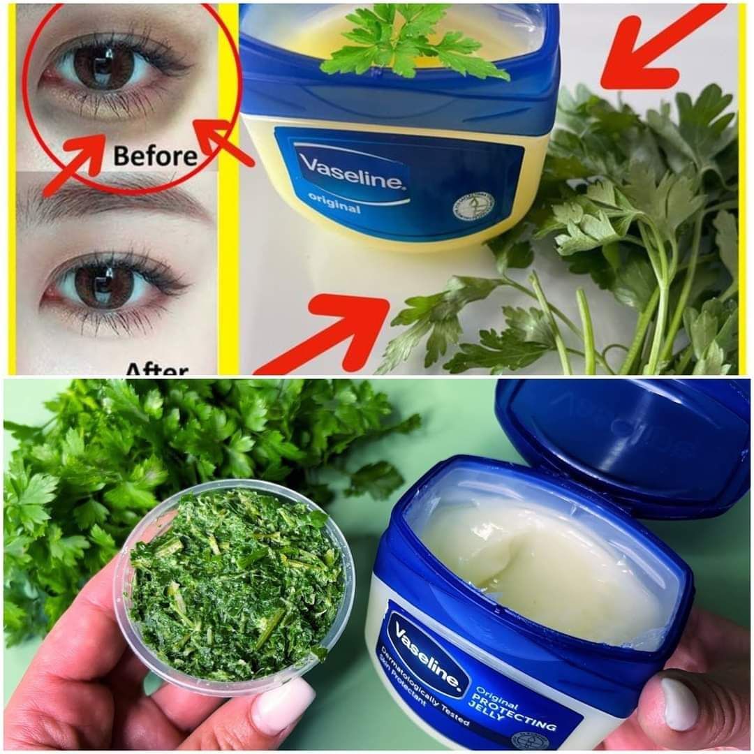 Benefits of a DIY Vaseline and Parsley Collagen Mask 1