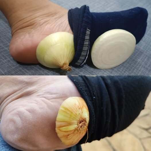 What Happens When You Sleep with Onions in Your Socks 1