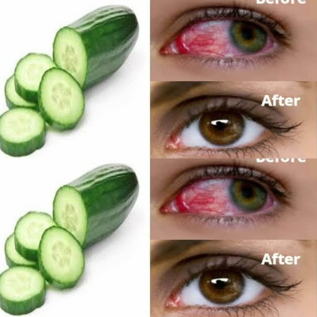 A Daily Cucumber Elixir for Enhanced Eyesight 1