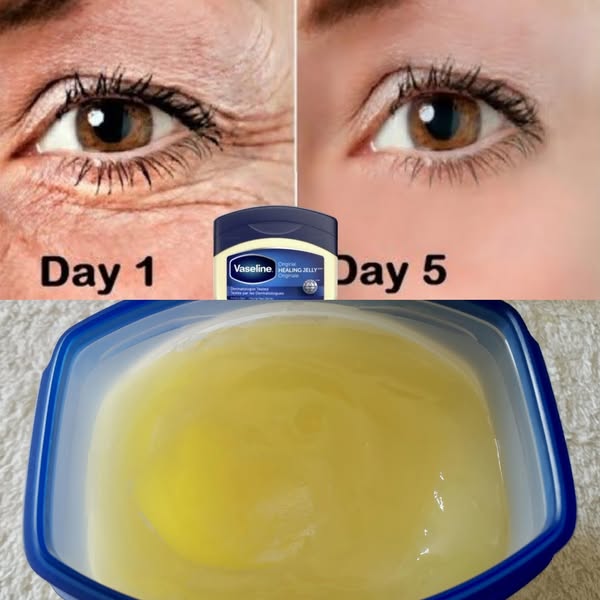 The Power of Vaseline to Remove Wrinkles 1
