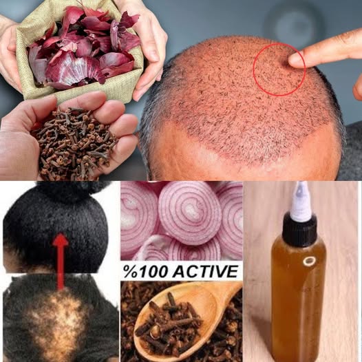 The Power of Cloves & Onion Peels 5