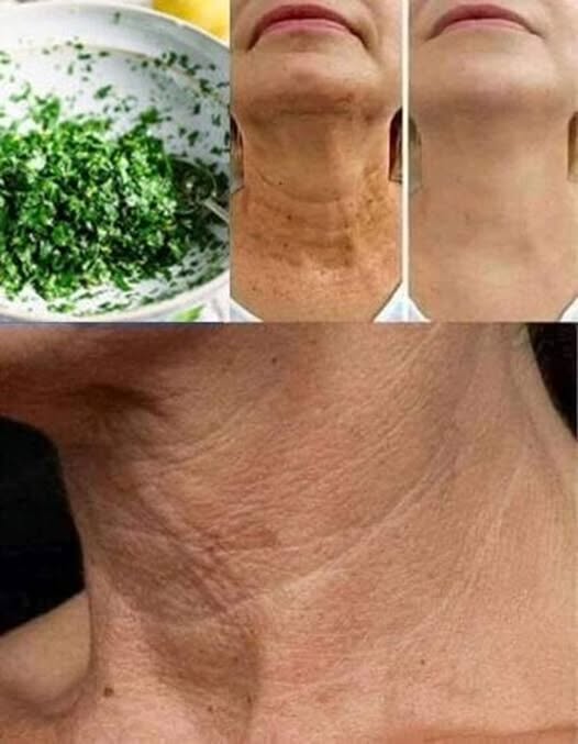 A Natural Collagen Boost with a Homemade Parsley Mask for Wrinkles and Spots 1