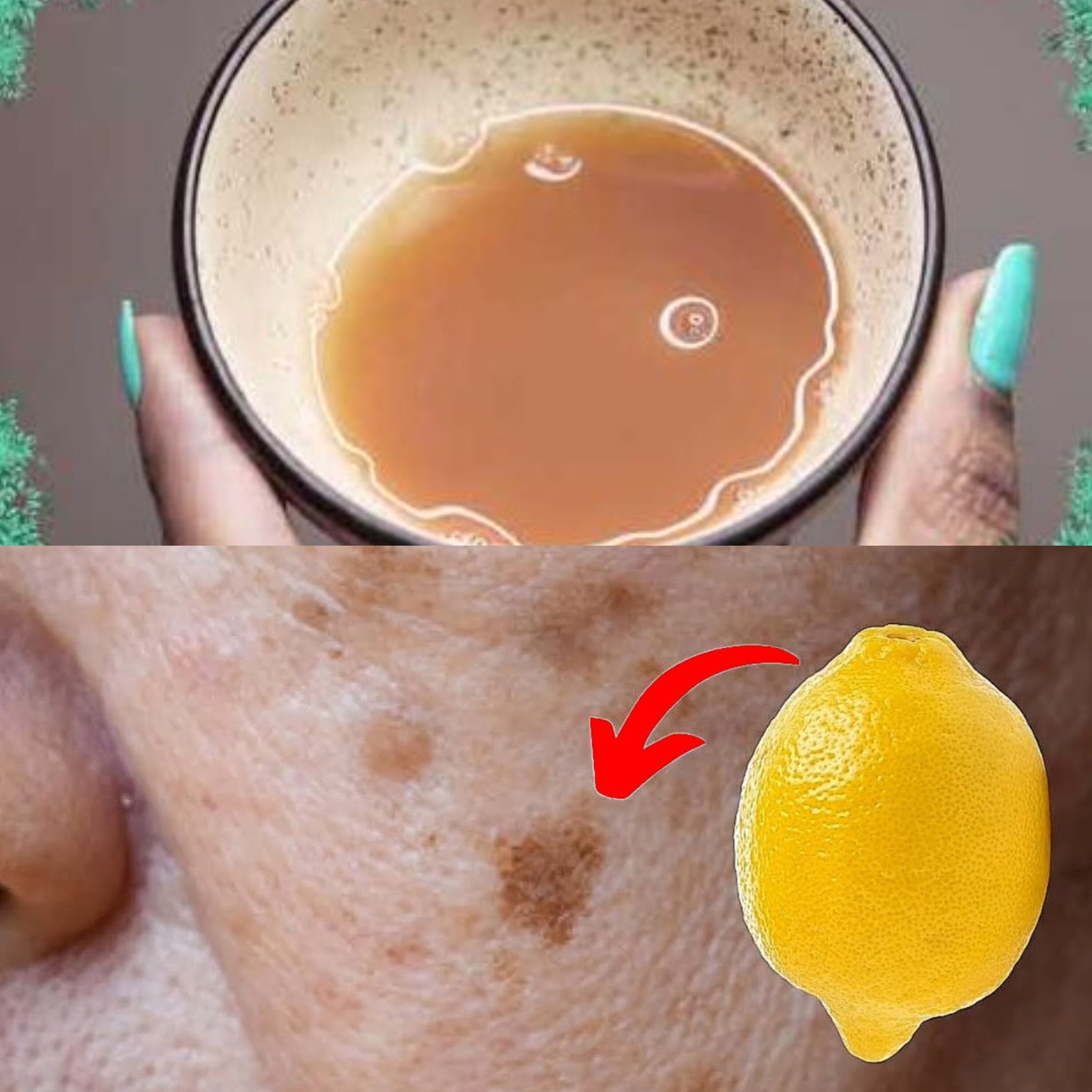 How to Remove Age Spots with Lemons 1