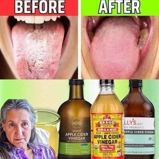 Apple Cider Vinegar Soak 1