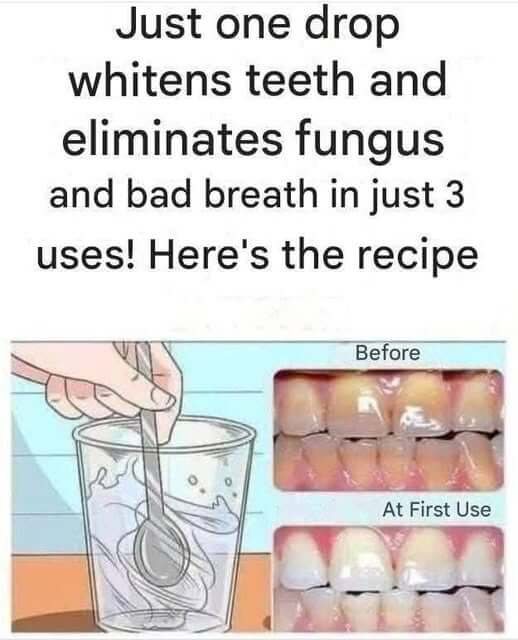 Remove tartar from your teeth and whiten them with this simple recipe 1