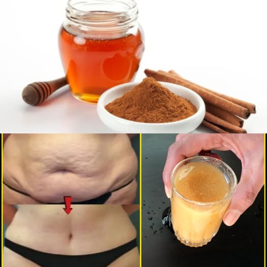 Cinnamon & Honey for Belly Fat – A Simple and Powerful Remedy! 1