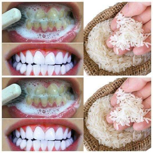 Rapid Teeth Whitening in 1 Minute! 1