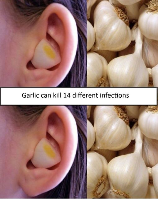 Garlic Can Kill 14 Different Infections 1
