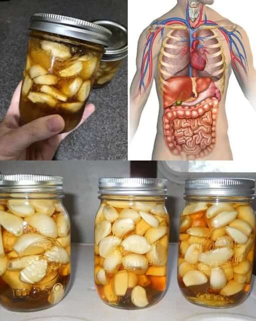 Unlocking the Power of Garlic, Cloves, and Honey: Your Natural Health Solution 1