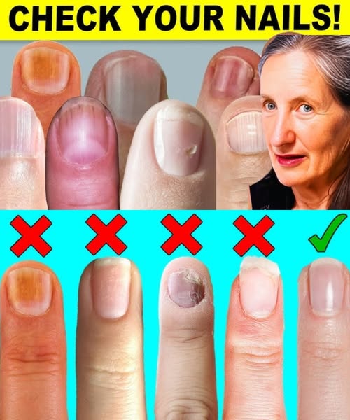 9 Things Your Nails Can Tell You About Your Health 1