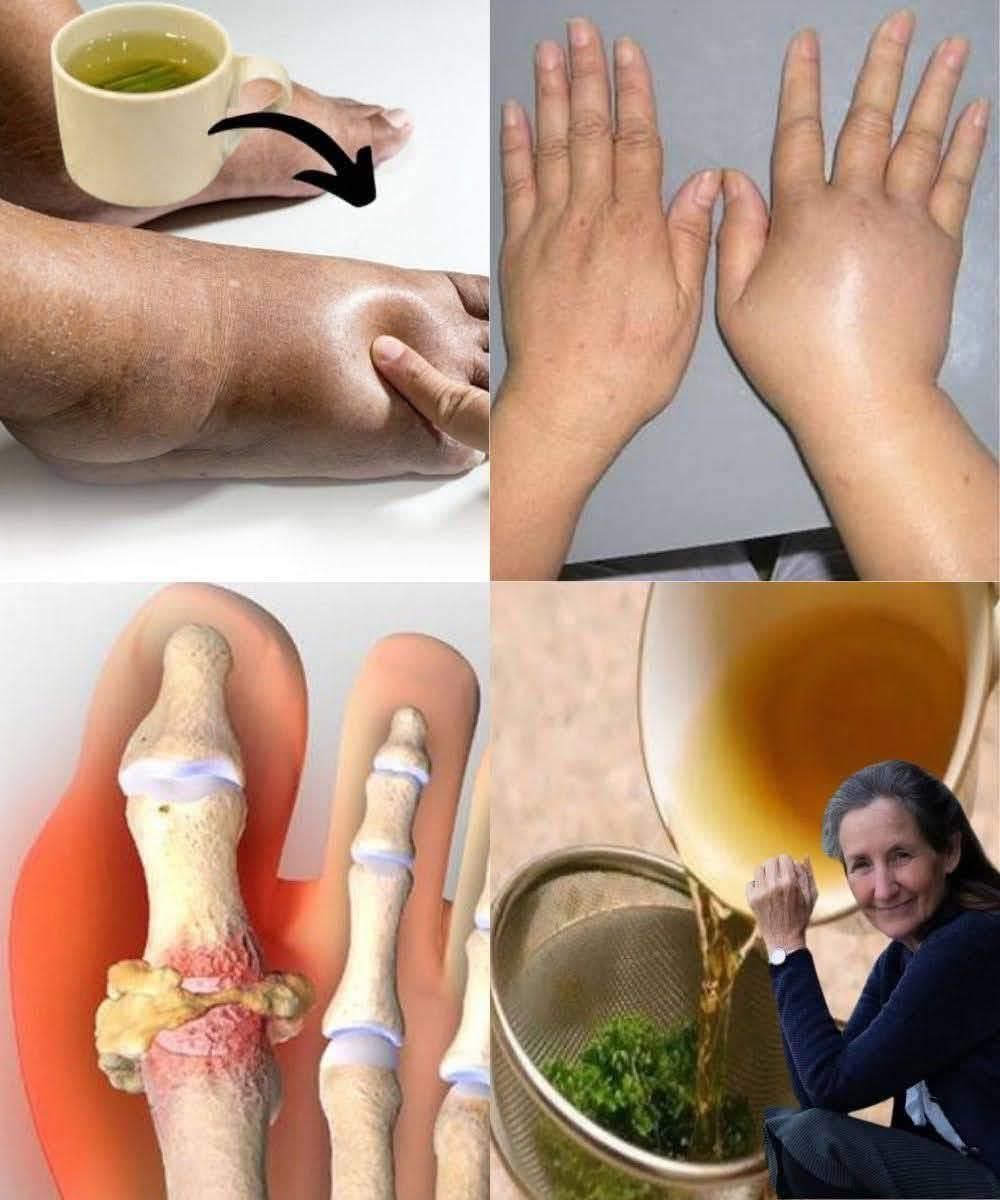 Say Goodbye to Swollen Legs, Ankles & Feet 1