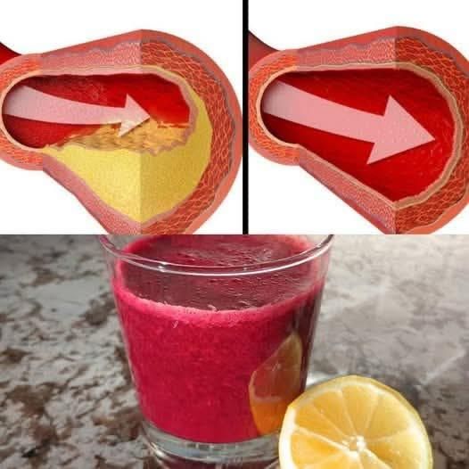 The Miracle Heart-Healthy Juice 1