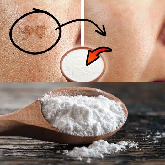 How I Erased My Age Spots with a Cheap Kitchen Ingredient: Baking Soda 1