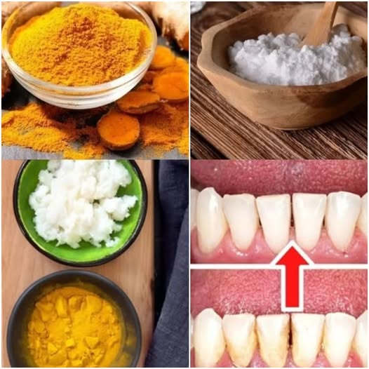 Remove Tartar and Plaque at Home Without a Dentist: Turmeric and Baking Soda 1