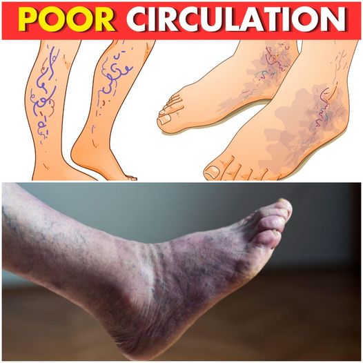 5 Warning Signs of Poor Circulation and How to Improve It Naturally 1