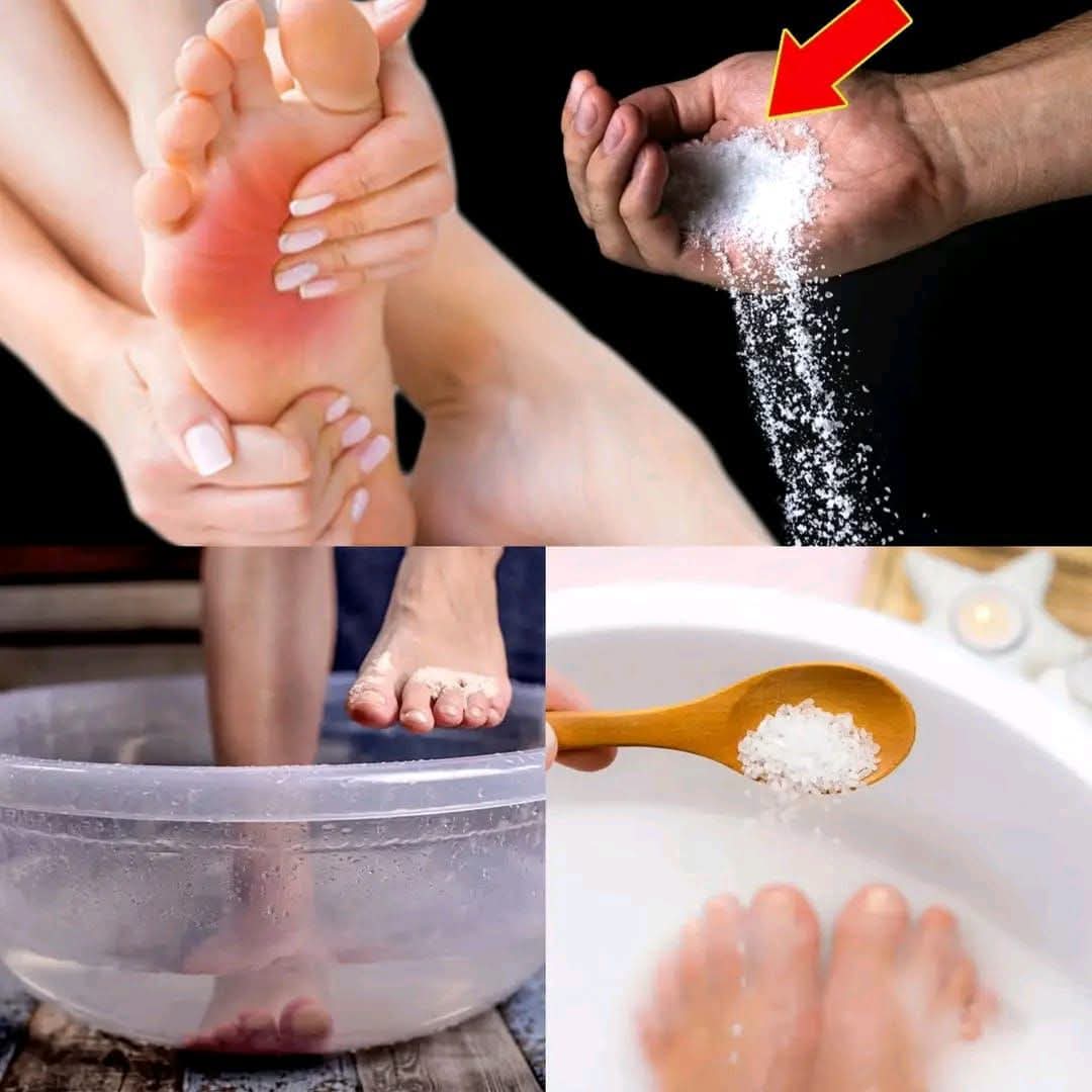 Salt Can Help Relieve Cramps, Arthritis, Tingling, Osteoarthritis & Inflammation 1