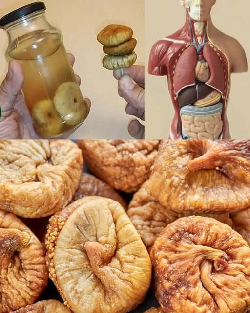 Natural Remedy for Managing High Cholesterol and Healthy Arteries 1