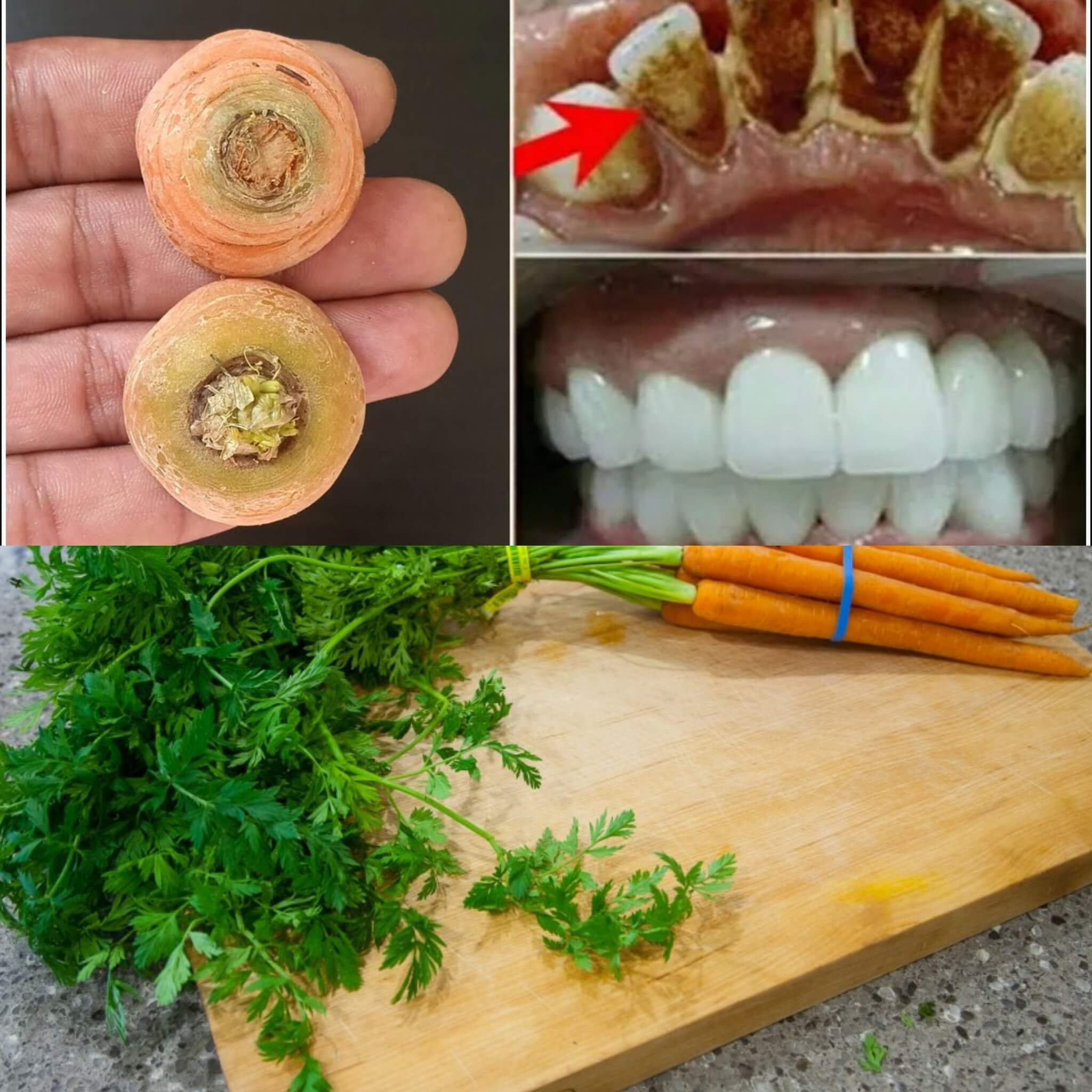 This Yellow Trick Using Carrot Tops Can Whiten Unclean Teeth Like Pearls in Just Two Minutes 1