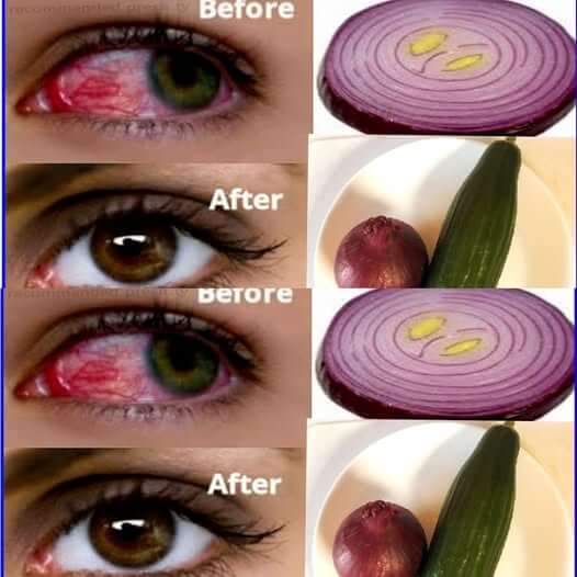 Improve Your Eyesight Naturally at Home in 5 Days 1