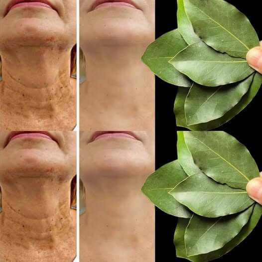 Bay Leaf The Natural Wrinkle Eraser for Ageless Beauty 1