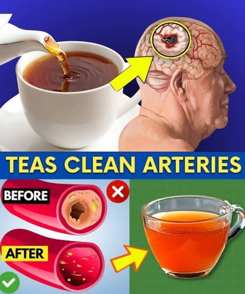 Better Than Aspirin! Teas That Naturally Help Prevent Blood Clots After 50 1