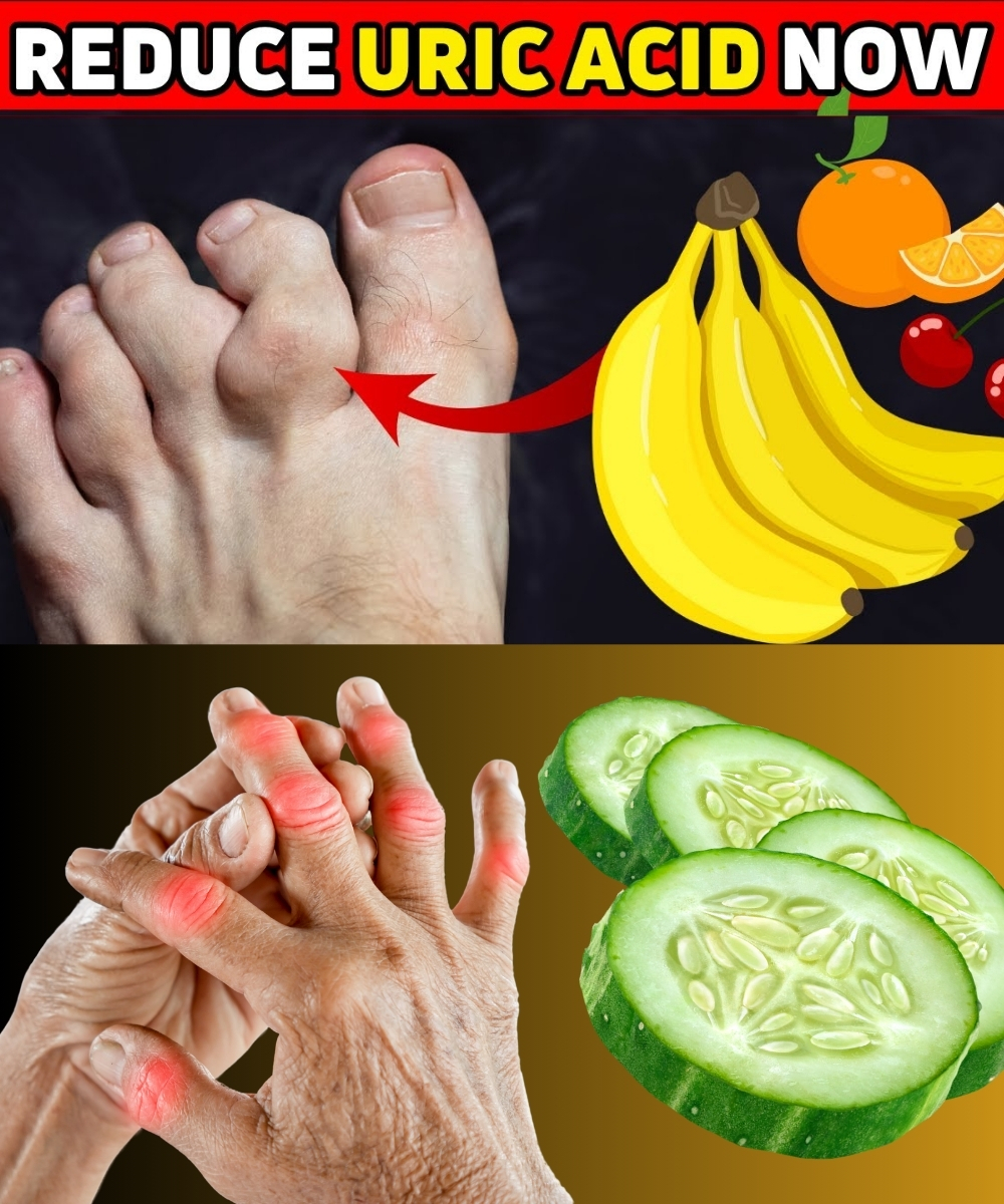 The Top 8 Natural Foods That Lower Uric Acid Levels 1