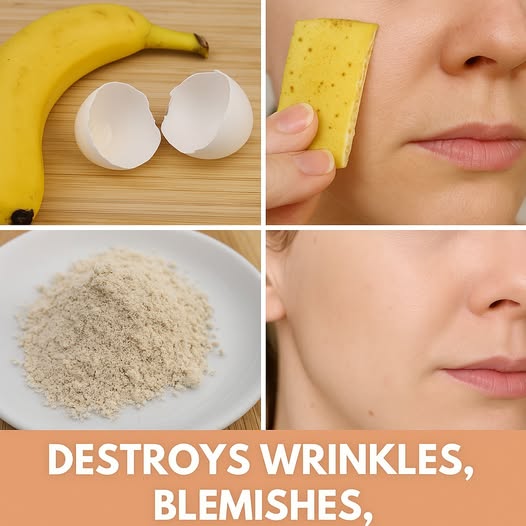 Natural Remedy for Skin Imperfections: Banana Peels and Baking Soda 1