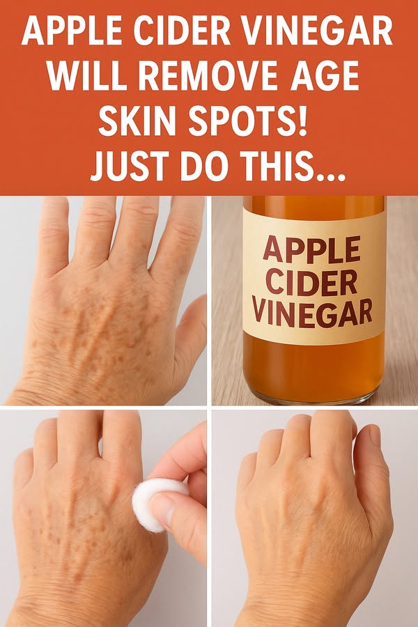 Apple Cider Vinegar 6