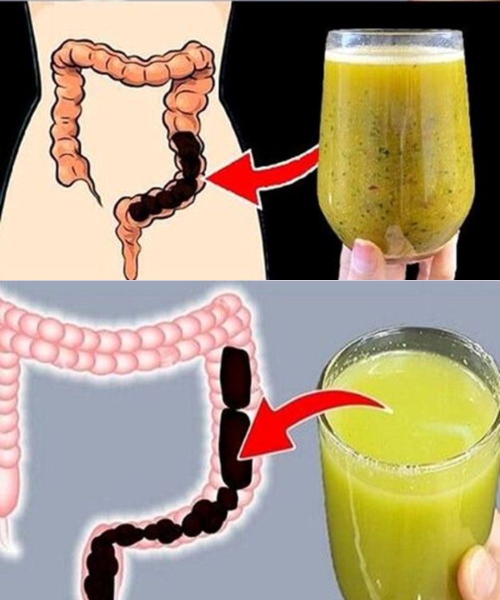 Lose Weight by Cleansing Your Colon? 1