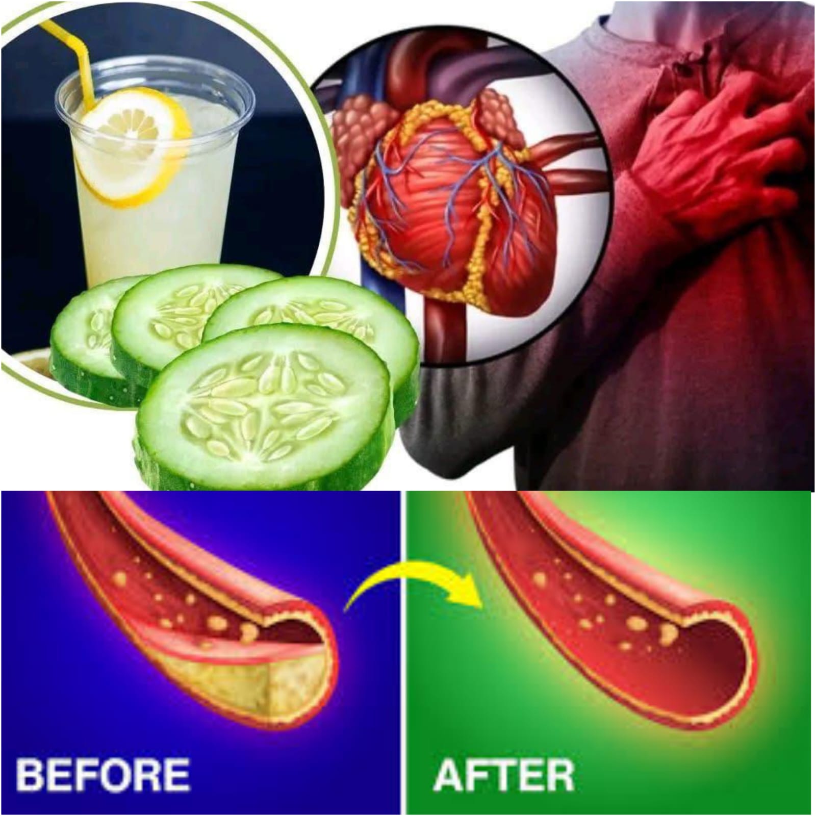 Naturally Assist in Unblocking Blocked Arteries 1