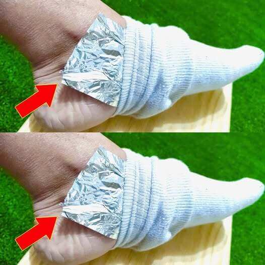 Aluminum Foil: A Surprising Natural Remedy for Your Feet 1