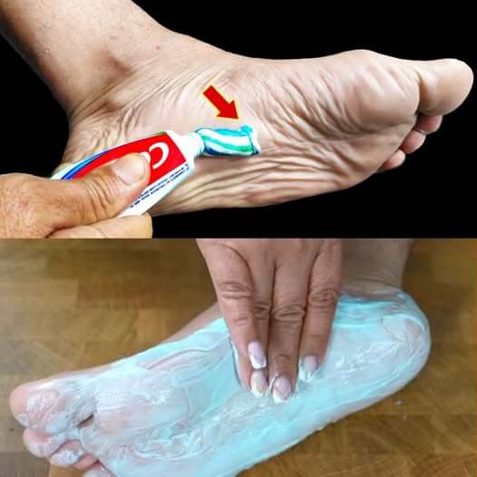 A quick and easy method to take care of your foot 1