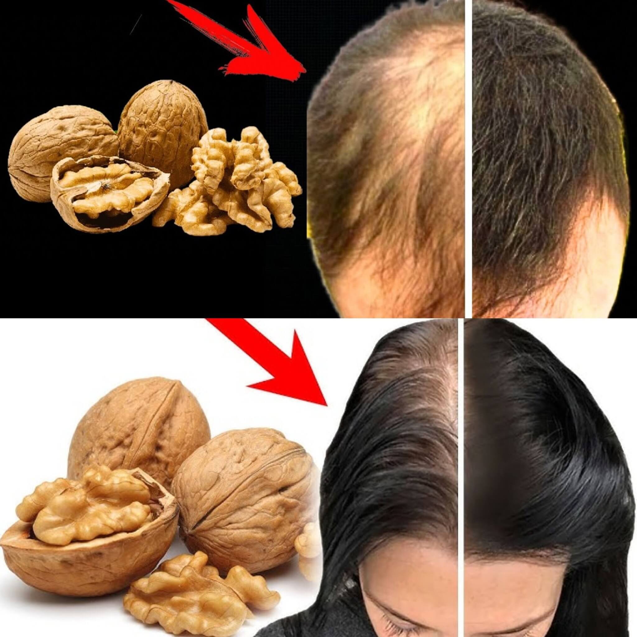 Hair Grows Like Crazy and Stops Falling Out 1