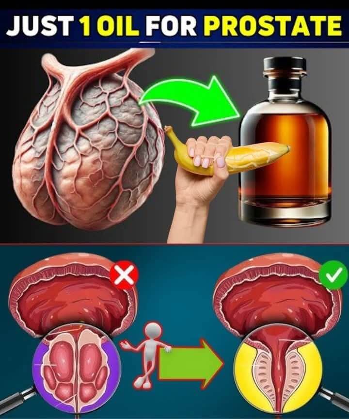 Old Doctors: These 6 Natural Oils Melt an Enlarged Prostate Fast 1