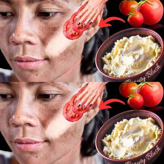 Rejuvenate Your Skin Naturally with a Tomato & Cornstarch Mask 1