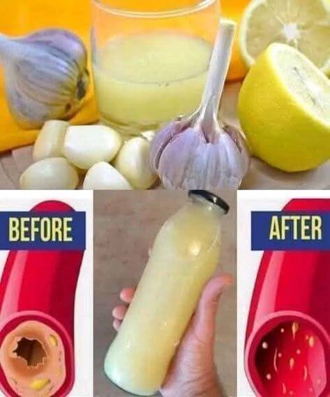 Refresh Your Body with Lemon & Garlic Detox Remedy 1