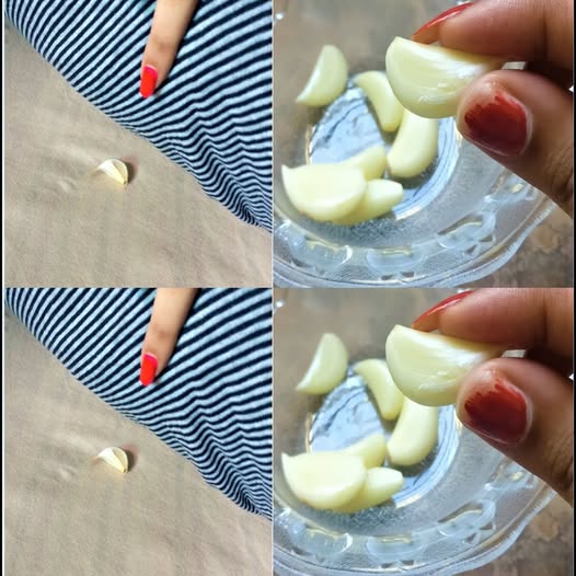 The Surprising Benefits of Sleeping With Garlic Under Your Pillow 1