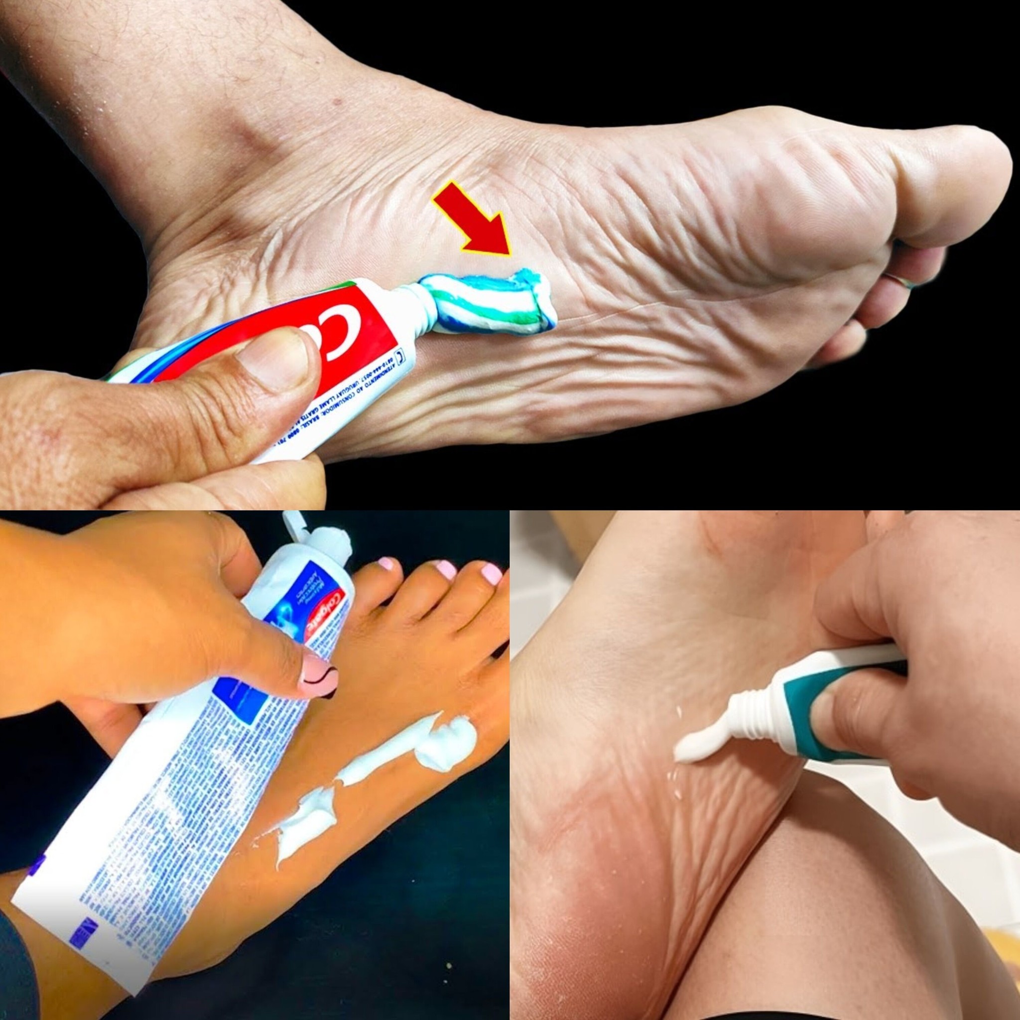 You’ll Be Surprised What Happens When You Put Toothpaste on Your Feet 1