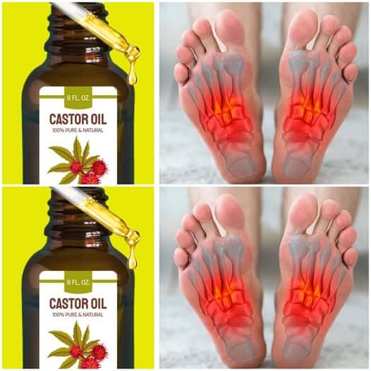 Discover the Magic of Castor Oil Before Bedtime 1