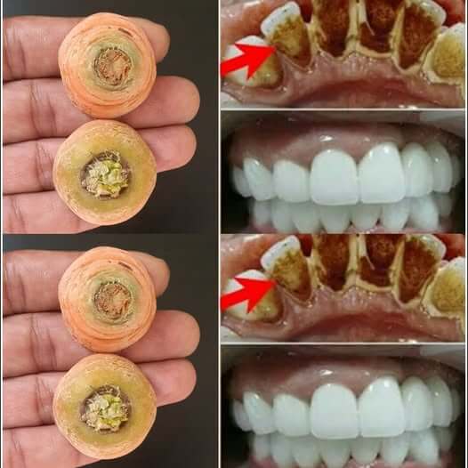 Brighten Your Smile with Carrot Tops 1