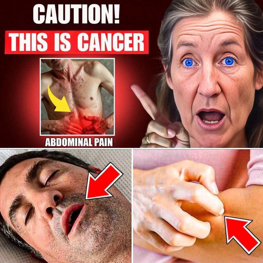 ALERT! 10 Strange Symptoms of Pancreatic Cancer Few People Notice 1