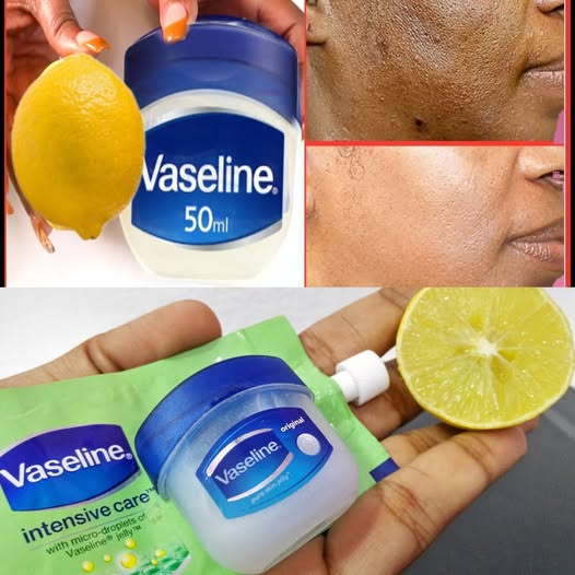 Vaseline and Lemon for Clear, Glowing Skin 1
