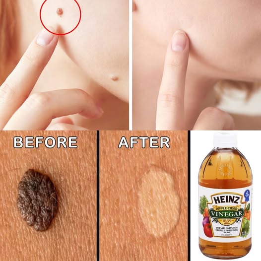 Natural Ways to Improve Skin Health 1