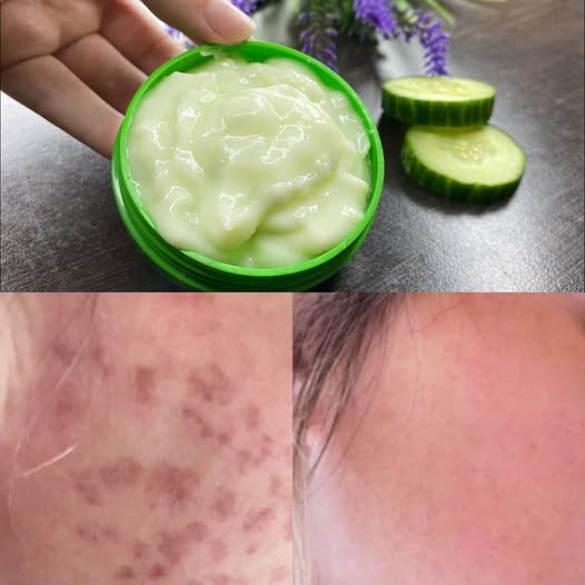 Rejuvenating Cucumber Face Cream Recipe for Youthful Skin 1