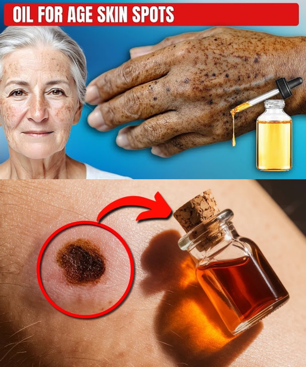 Apply Just 1 Drop Natural Oil Remedy to Erase Age Spots Forever 1
