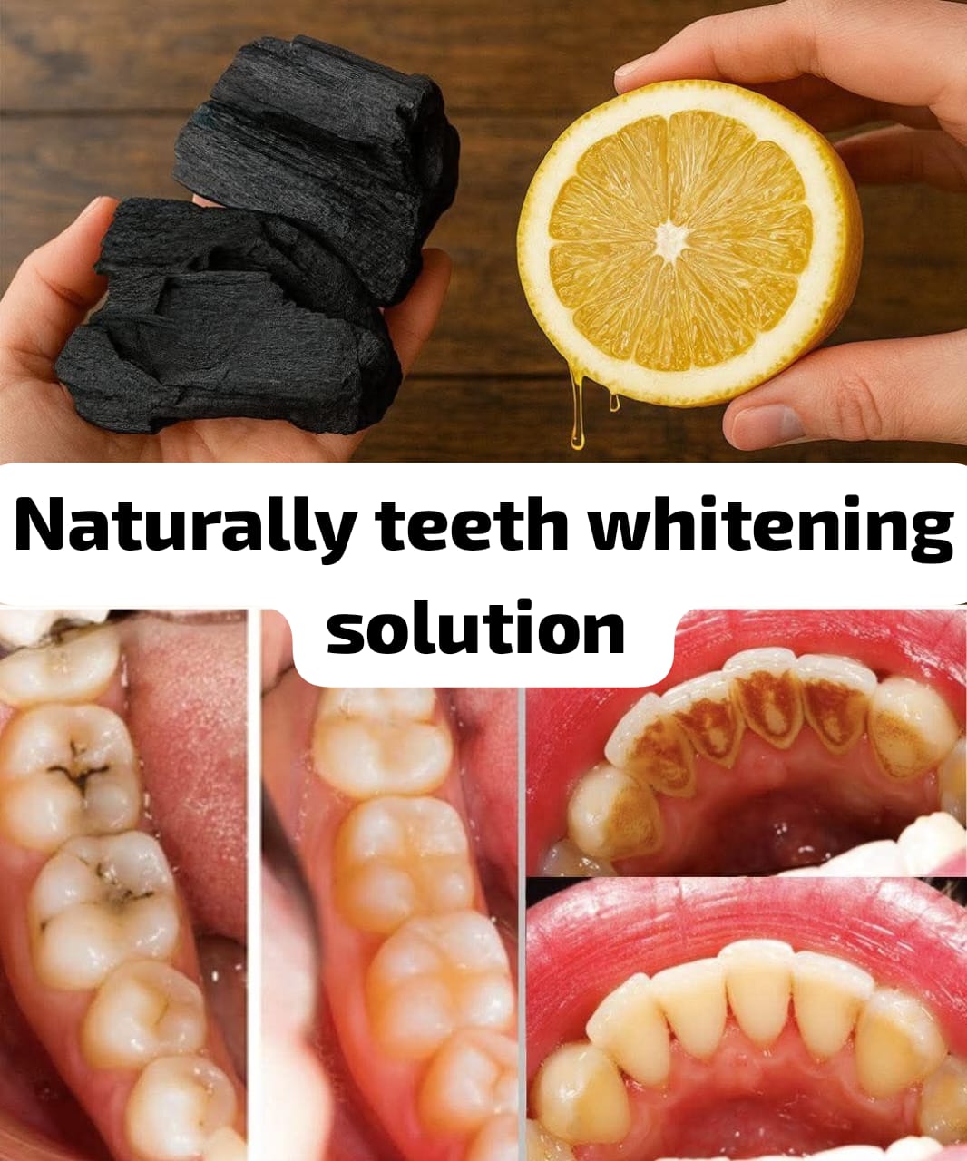 At-Home Natural Teeth Whitening Solution 1