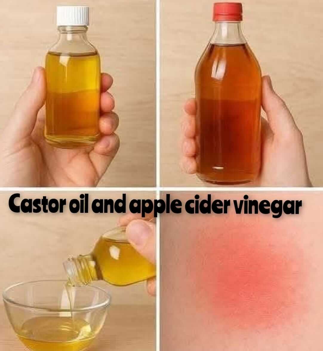 Harnessing the Power of Castor Oil and Apple Cider Vinegar for Your Health 1